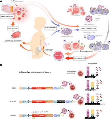 Frontiers | The Future Of Gene Therapy For Transfusion-Dependent Beta ...